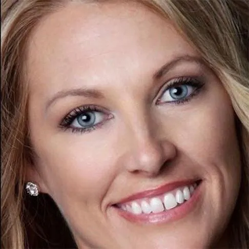 Before Smile image 3