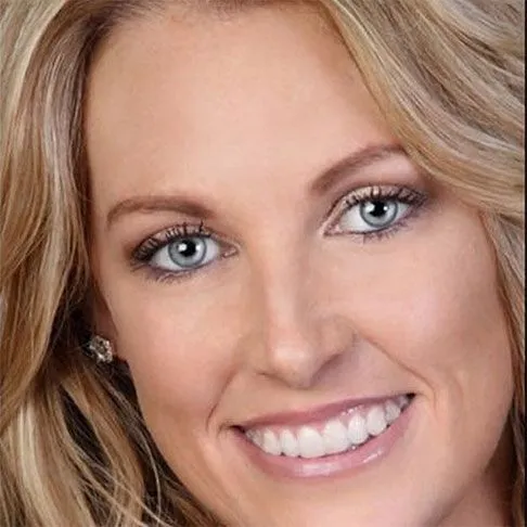 After smile image