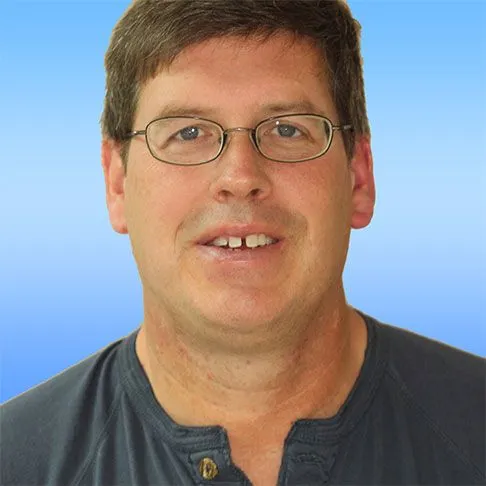 Before smile image Rick