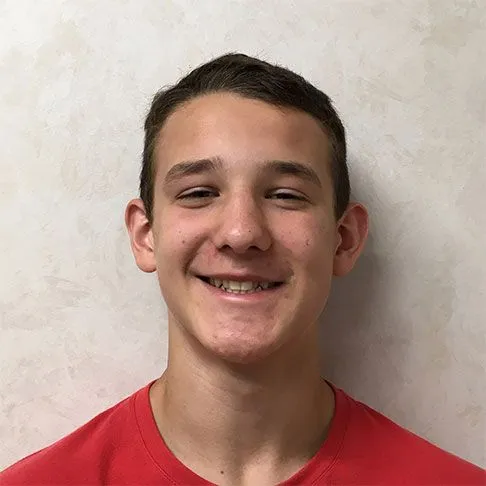 Jarret Before smile shot
