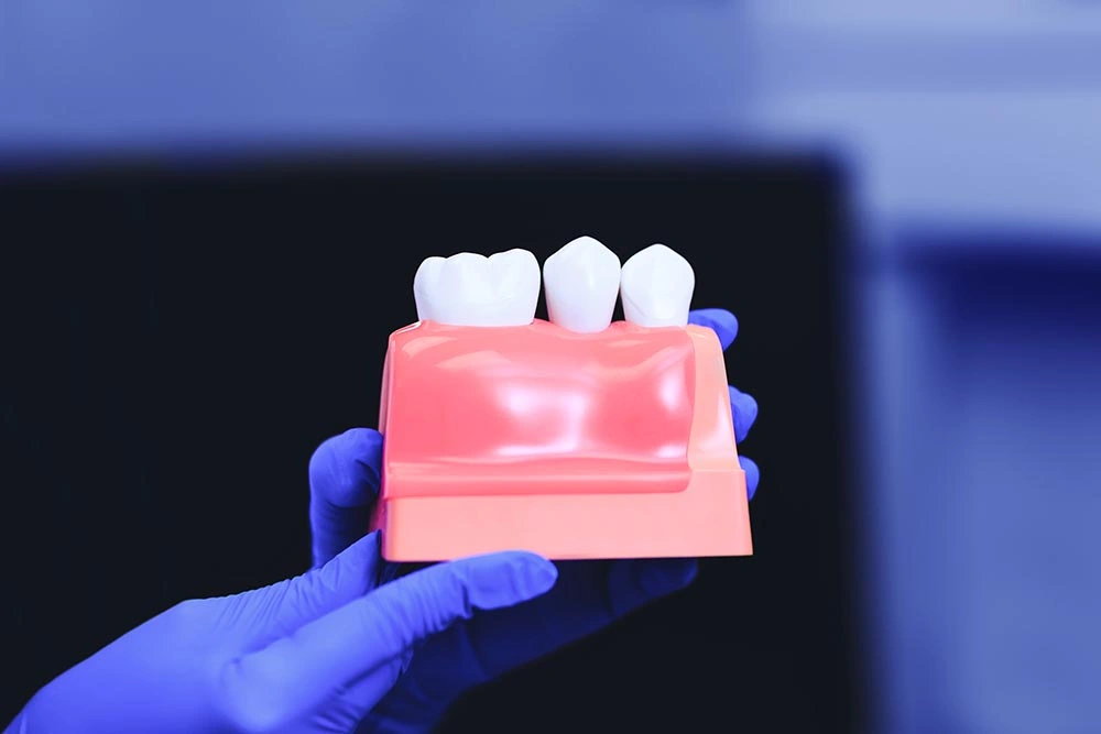 Dental-Implants-&-Tooth-In-Hand
