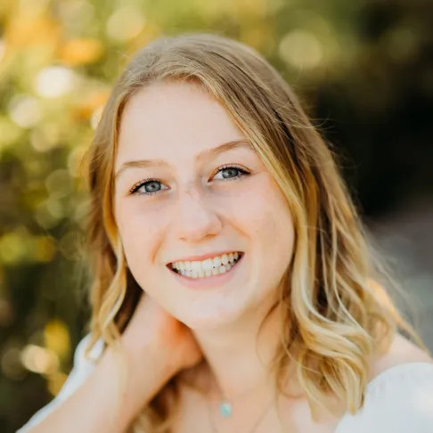 After smile image Josie