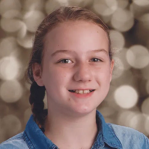 Josie before smile image