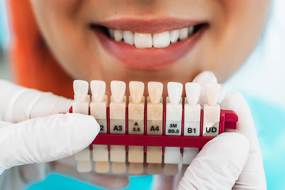 Prosthetic-Dentistry-Matching