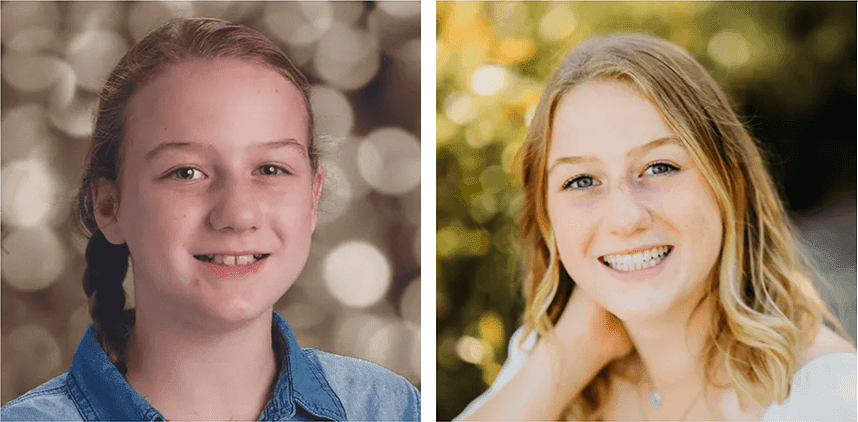 before and after