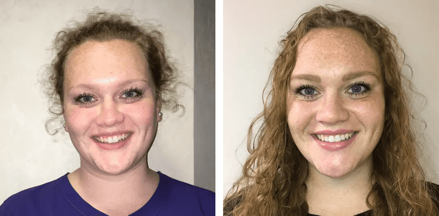 before and after