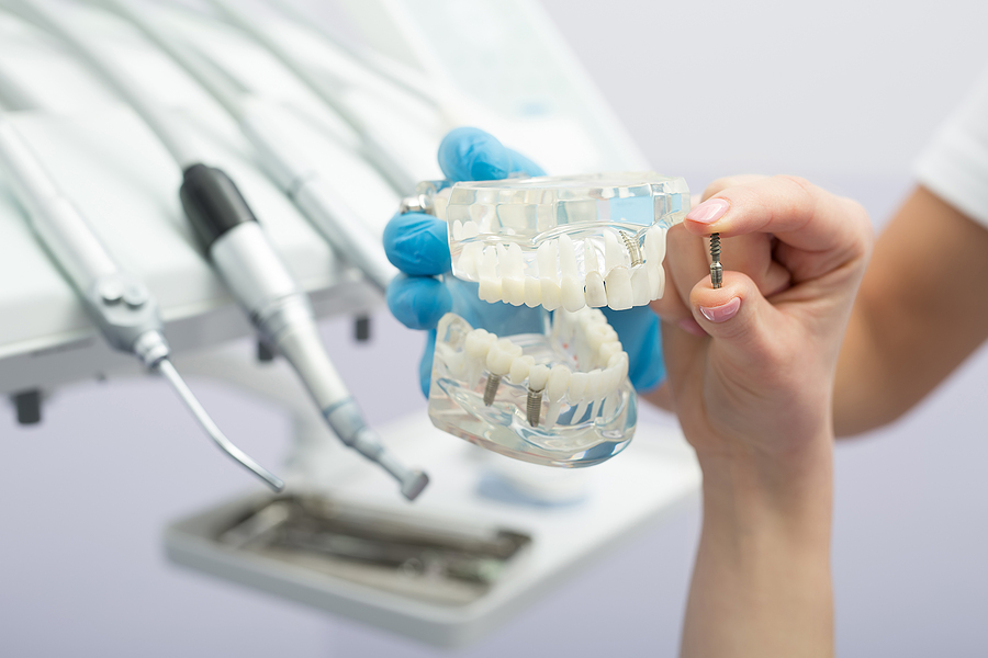 How Dental Implants Improve Chewing Function