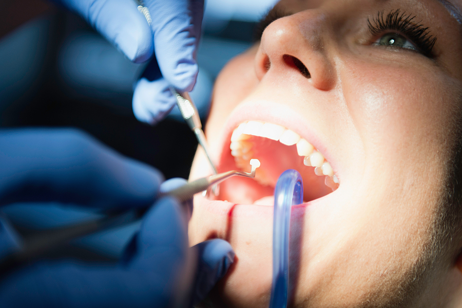 Top Trends in Cosmetic Dentistry in 2026